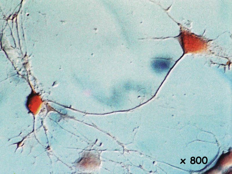 neurone2_MEB_x800.jpg - LEAD Technologies Inc. V1.01